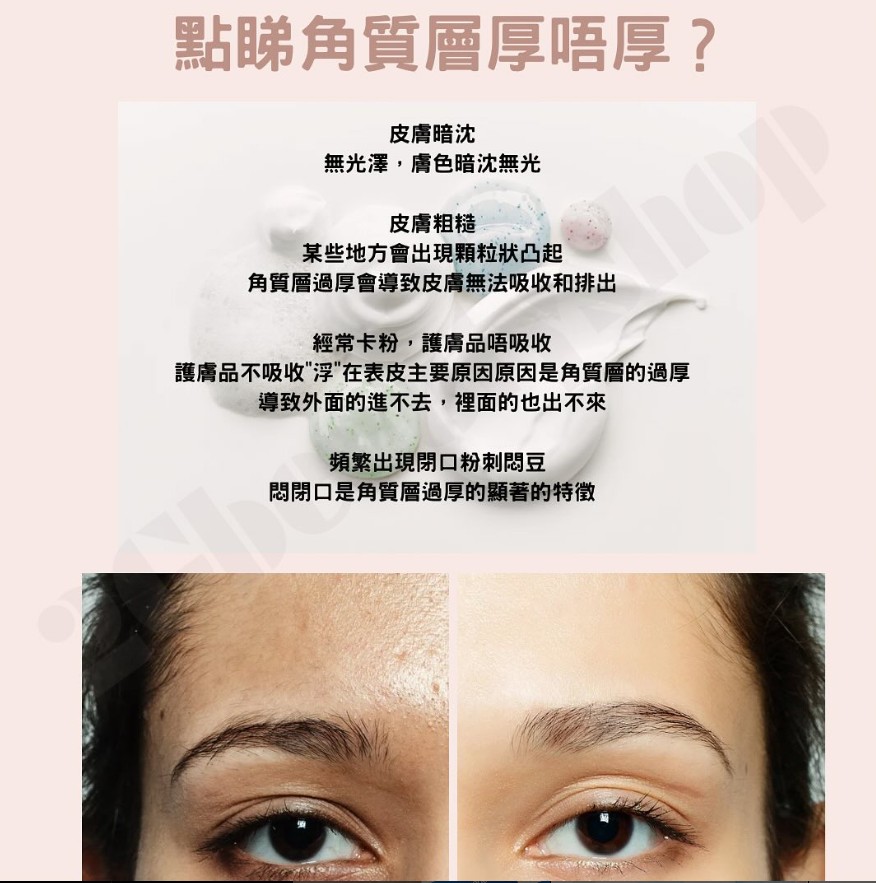 為何要定期去角質