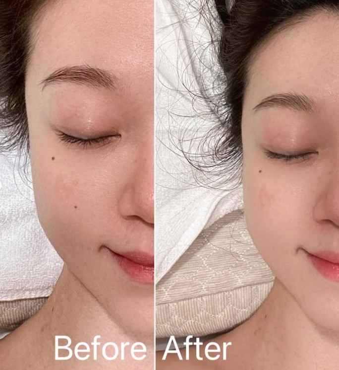 而家一般嘅Facial已經滿足唔到我