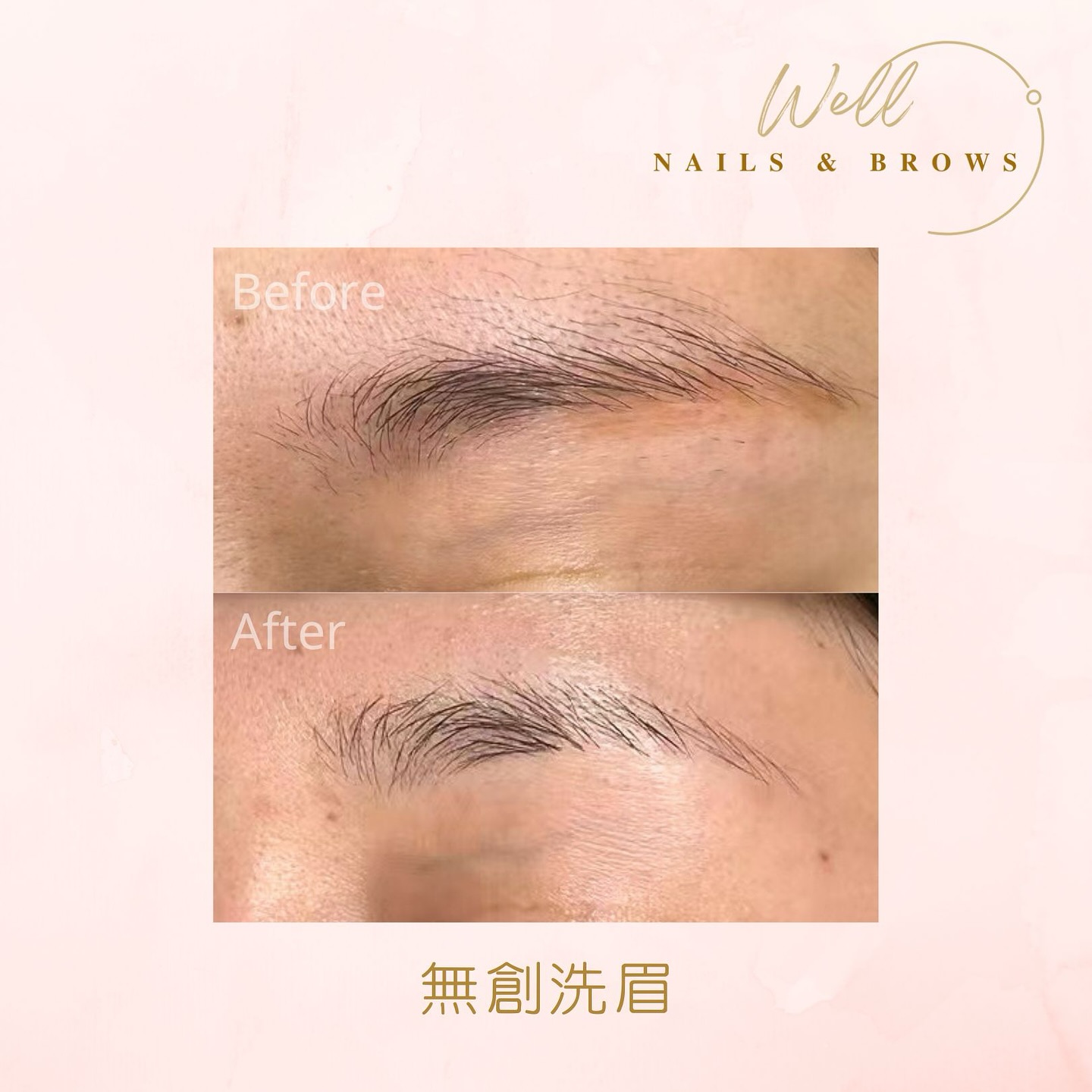 無創洗紅眉技術