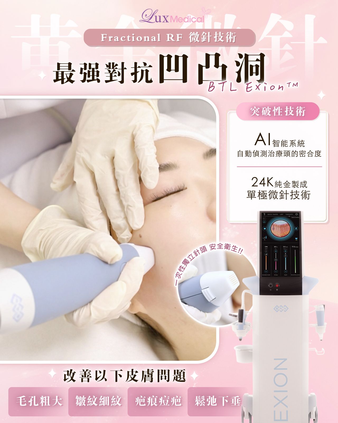 BTL第5代EXION🌟黃金微金十 🌟