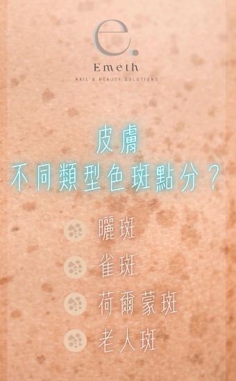 不同類型色斑點分？
