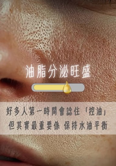油肌 / 出油多護理專業知識