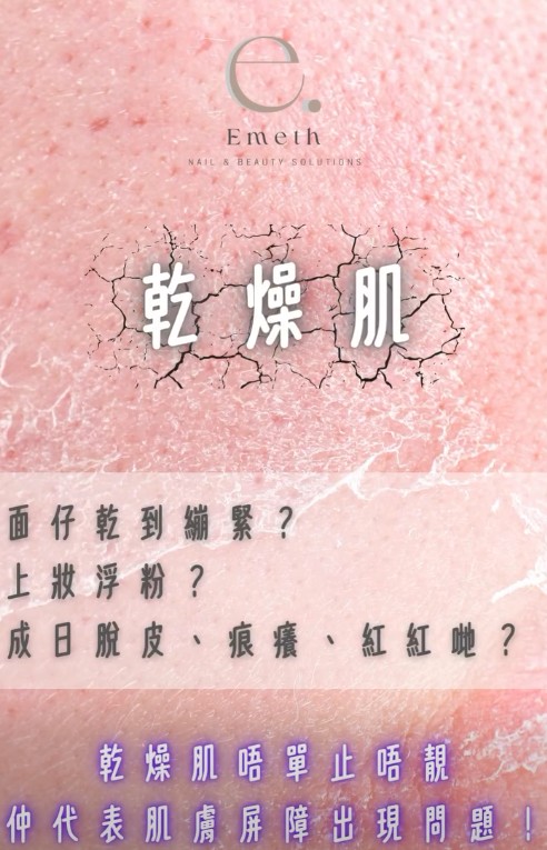 乾燥脫皮肌救星