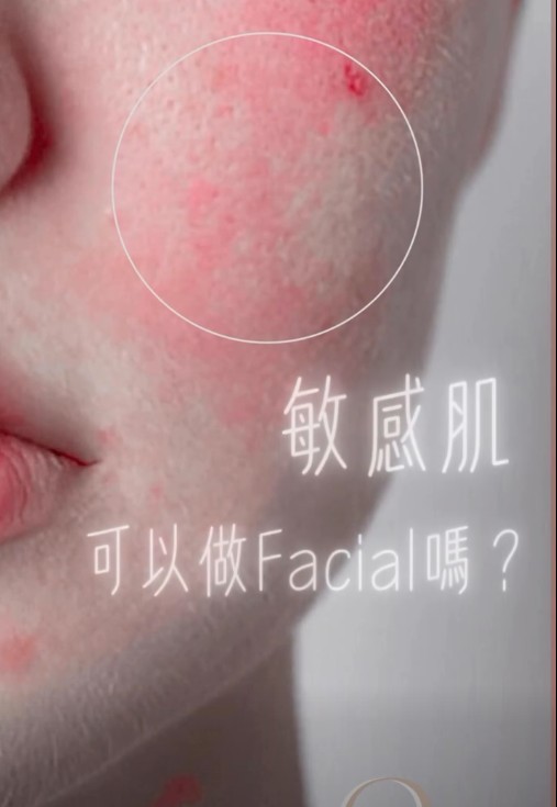 敏感肌可以做Facial嗎？