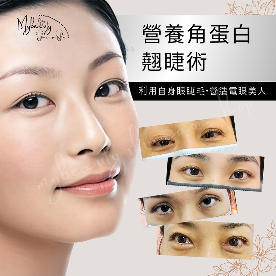 角蛋白睫毛翹睫術