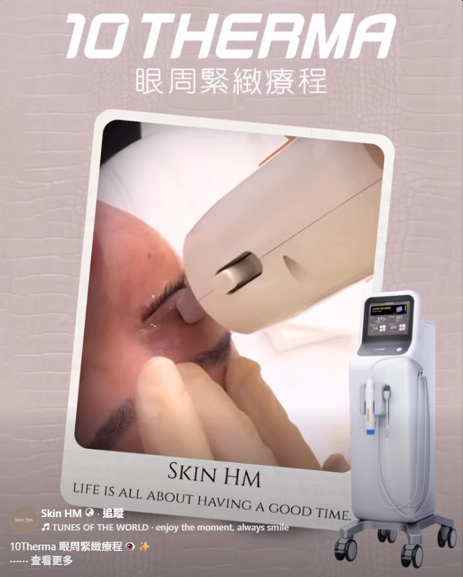 10Therma 眼周緊緻療程