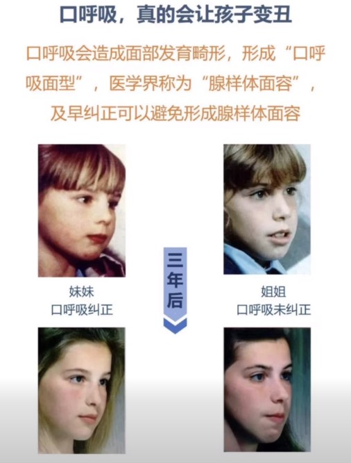 你仲用緊口呼吸？