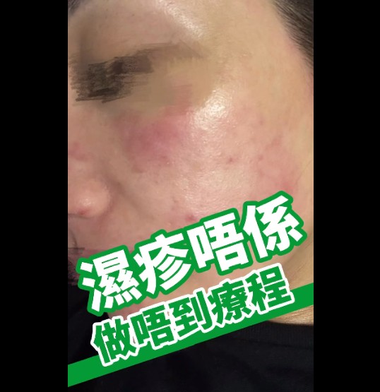 從濕疹肌，到而家幫人做機