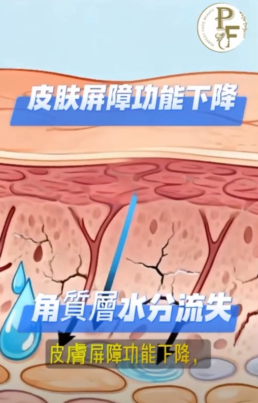 乾紋出現，其實唔只係缺水