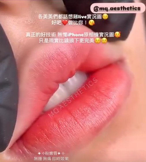 仲擔心緊做半永久嘴唇會腫到變孖膶腸