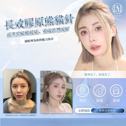 以前放電是「低電壓」