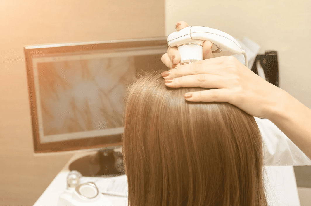 頭皮養護與生髮護理