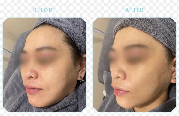 金離子亮肌無暇