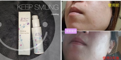 口罩肌潔淨啫喱Maskne Cleansing Gel