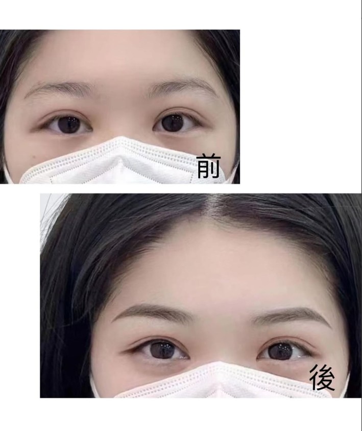 眉毛