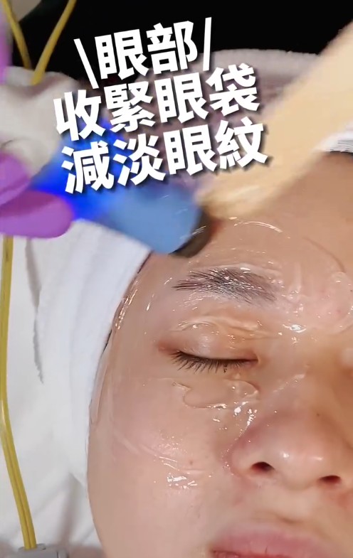 無入侵性美容機都可以針對五官做調整