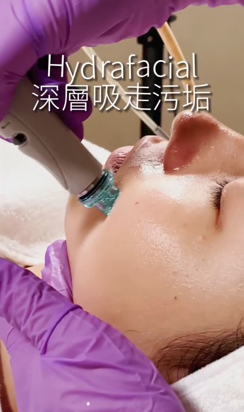 30年獨家針清手法大揭秘