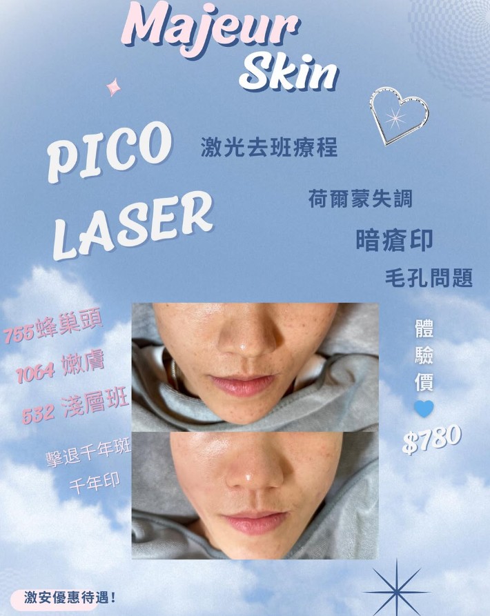  pico Laser 「專業療程」