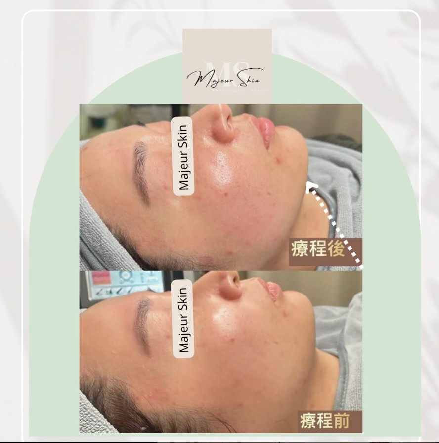 夠老友係尖沙咀入黎支持小店主