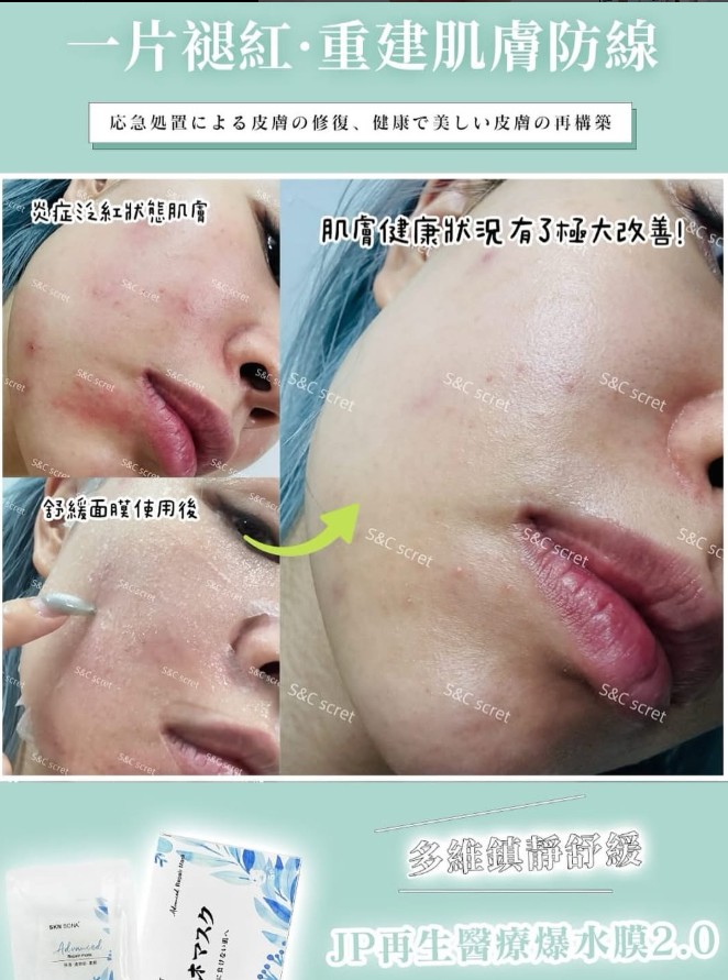 S&C 爆水膜2.0｜炎症泛紅急救專家
