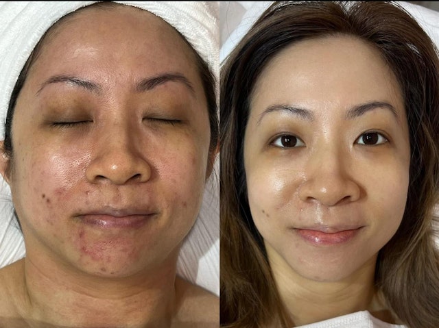 BEAUSTAY的每一項服務都為客人度身訂造。透過專業的審美眼光，針對每位客人的臉型、膚質及個人需求，制定最合適的療程方案。