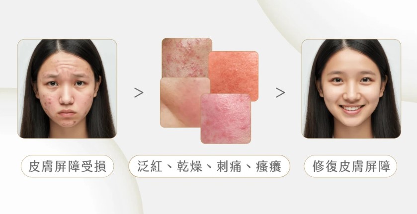 敏感肌修復護理